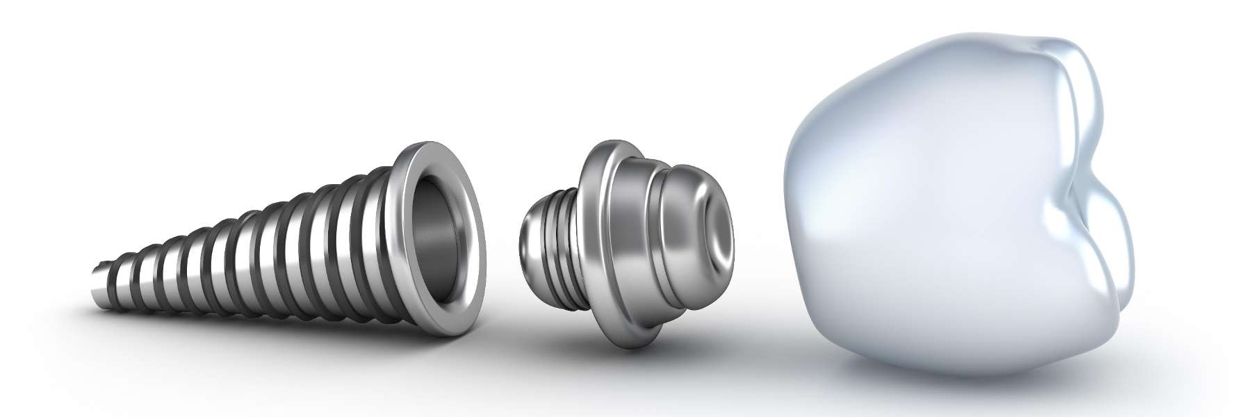 An illustration of a dental implant in Bastrop, TX