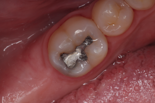 Direct-Composites-Before-Image